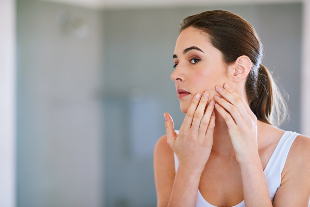 The Best Ways to Prevent Acne image